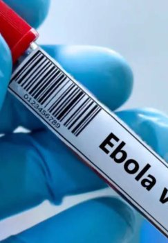 Kongoda Ebola virusidan ikki yuzdan ortiq kishi vafot etdi