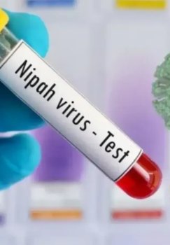 Nipax virusiga qarshi vaksina sinovlari boshlanmoqda