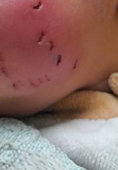 Gazo aholisi endi och qolgan kemiruvchilar hujumidan aziyat chekmoqda