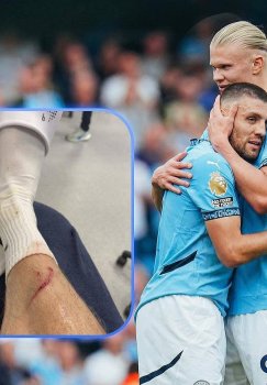 Erling Haaland took his injury with humor