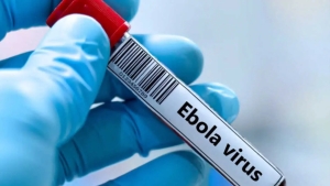 Kongoda Ebola virusidan ikki yuzdan ortiq kishi vafot etdi