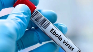 Kongoda Ebola virusidan ikki yuzdan ortiq kishi vafot etdi