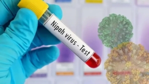 Nipah virus vaccine trials are beginning