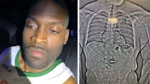 Amerikalik erkak o‘g‘irlagan 770 ming dollarlik sirg‘alarni yutib yubordi (video)