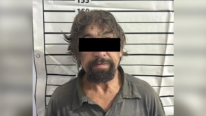 A woman who was beaten by a man in Chuy died