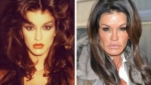 Celebrities changed appearance after plastic surgery