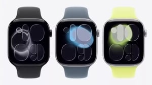 Apple Watch Series 11 supports 5G network