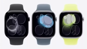 Apple Watch Series 11 5G tarmog‘ini qo‘llaydi