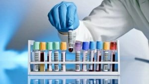 Laboratory system in Uzbekistan will be reformed by 2030