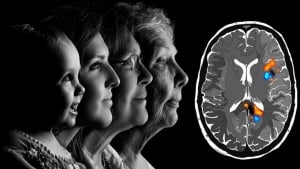 Five stages of human brain development identified