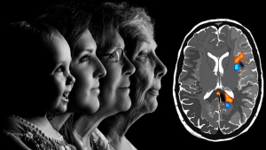 Определены пять этапов развития человеческого мозга