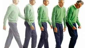 Parkinson's disease can now be diagnosed in living individuals: A new breakthrough in medicine from Chinese scientists