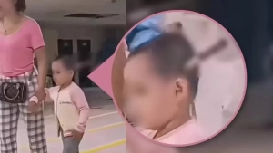 Kunmingda 3 yoshli qiz boshidan pichoq olib tashlandi