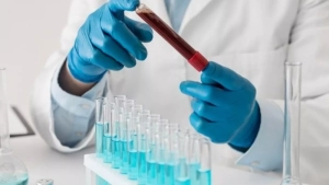 Gemato va onkogematologiya xizmatlari rivojlantiriladi