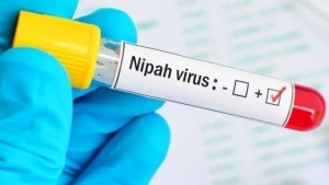 Nipah virus: No risk in Uzbekistan, be cautious!