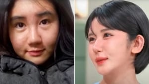 South Korean woman performed 400 surgeries in 15 years