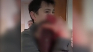 Qozogistonda bino bezagi tushib uch yoshli bola jarohatlandi