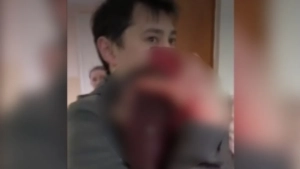 Qozogistonda bino bezagi tushib uch yoshli bola jarohatlandi