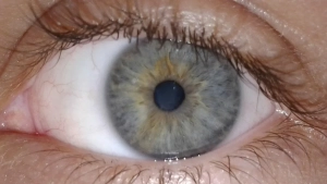 Ayolning ko‘zidan tirik parazit olib tashlandi