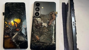 Samsung smartfoni foydalanuvchining cho'ntagida yonib ketishi oqibatida jarohatlandi