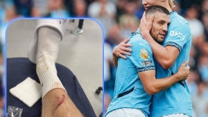 Erling Xoland jarohatini hazil bilan qabul qildi