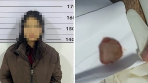 Qirg‘izistonda qiz o‘pish chog‘ida yigit tilini tishladi