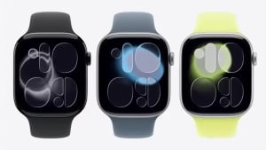 Apple Watch Series 11 5G tarmog‘ini qo‘llaydi