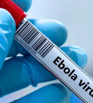 Kongoda Ebola virusidan ikki yuzdan ortiq kishi vafot etdi