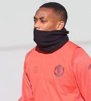 Marsyal jarohatlandi: tiklanish muddati noma’lum