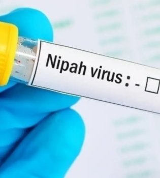 Nipah virusi: O‘zbekistonda xavf yo‘q, ehtiyot bo‘ling!