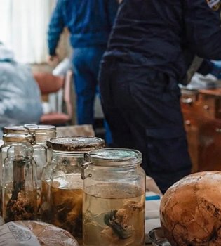 A doctor in Hungary was caught cooking a meal with the remains of his patients.