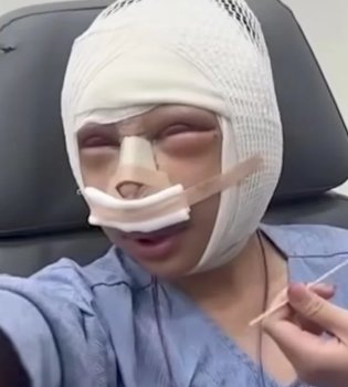 Tashqi ko'rinishi tanqid qilingan ayol plastik jarrohlikka qo'l urdi