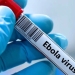 Kongoda Ebola virusidan ikki yuzdan ortiq kishi vafot etdi