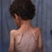 The number of hunger victims is increasing in the Gaza Strip