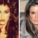Celebrities changed appearance after plastic surgery