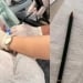 В сельской больнице из желудка были извлечены две ручки