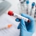 Mandatory medical examinations for HIV and infections have been introduced