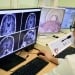Ученые Стэнфорда создали мозговой имплантат для речи