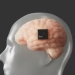 Neuralink 12 kishining miyaga implant o‘rnatdi