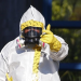 Fransiyada Ebola virusini yuqtirgan ilk bemor to'liq sog'aydi