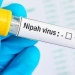 Nipah virus: No risk in Uzbekistan, be cautious!