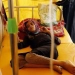 Cholera epidemic in Yemen has gotten out of control