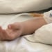 Toshkentda bola rinoplastika paytida vafot etdi