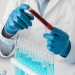 Gemato va onkogematologiya xizmatlari rivojlantiriladi
