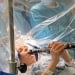 Woman Playing Clarinet with Parkinson's Disease Surgery
