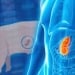 Pig liver transplanted to a human in China