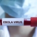 Ebola virusi aeroportlar orqali dunyoga tarqalishi mumkin