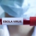 Ebola virusi aeroportlar orqali dunyoga tarqalishi mumkin