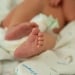 In India, two fetuses were removed from a baby’s abdomen