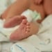 In India, two fetuses were removed from a baby’s abdomen
